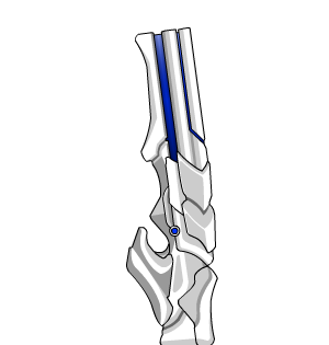 Tempest Soldier Blaster